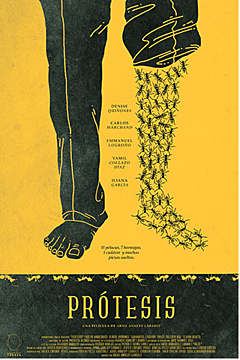 Prosthesis