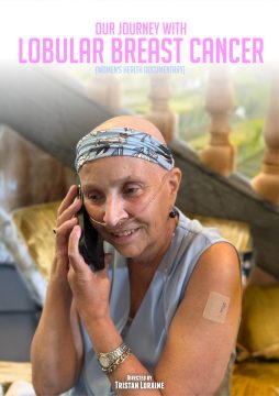 Our Journey with Lobular Cancer