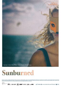 Sunburned